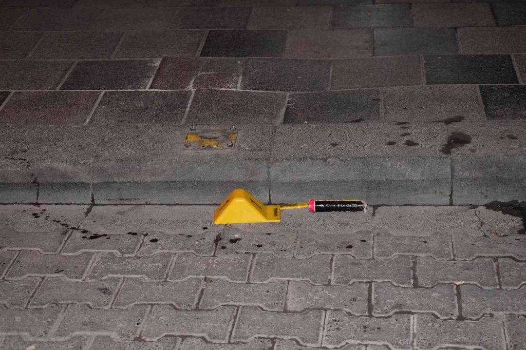 MALATYA – Doğum günü ‘meşalesi’ elinde patladı