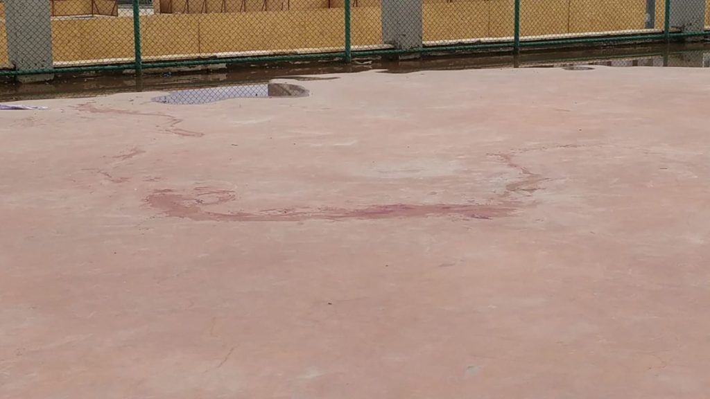 Pitbull cinsi iki köpeğin saldırdığı 4 yaşındaki çocuk ağır yaralandı