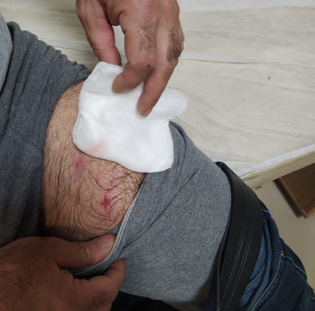 Bingöl’de köpek sürüsü, evine giden adama saldırdı