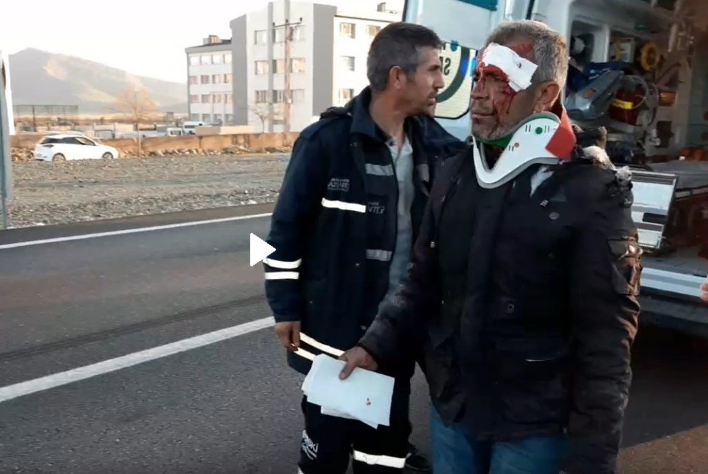 Yüzü gözü kanlar içinde kendisine çarpan aracı sordu