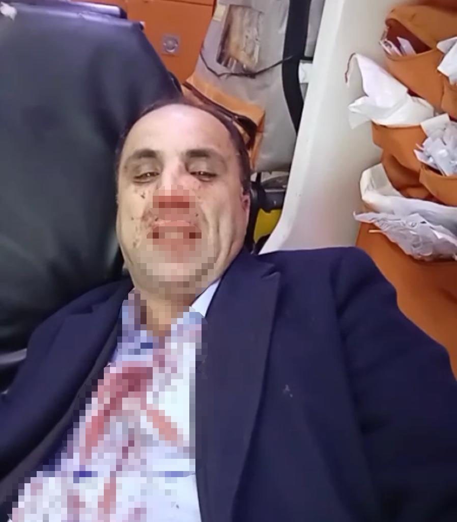 Diyarbakır Berberler, Kuaförler ve Güzellik Uzmanları Esnaf Odası başkanlık seçiminde kavga