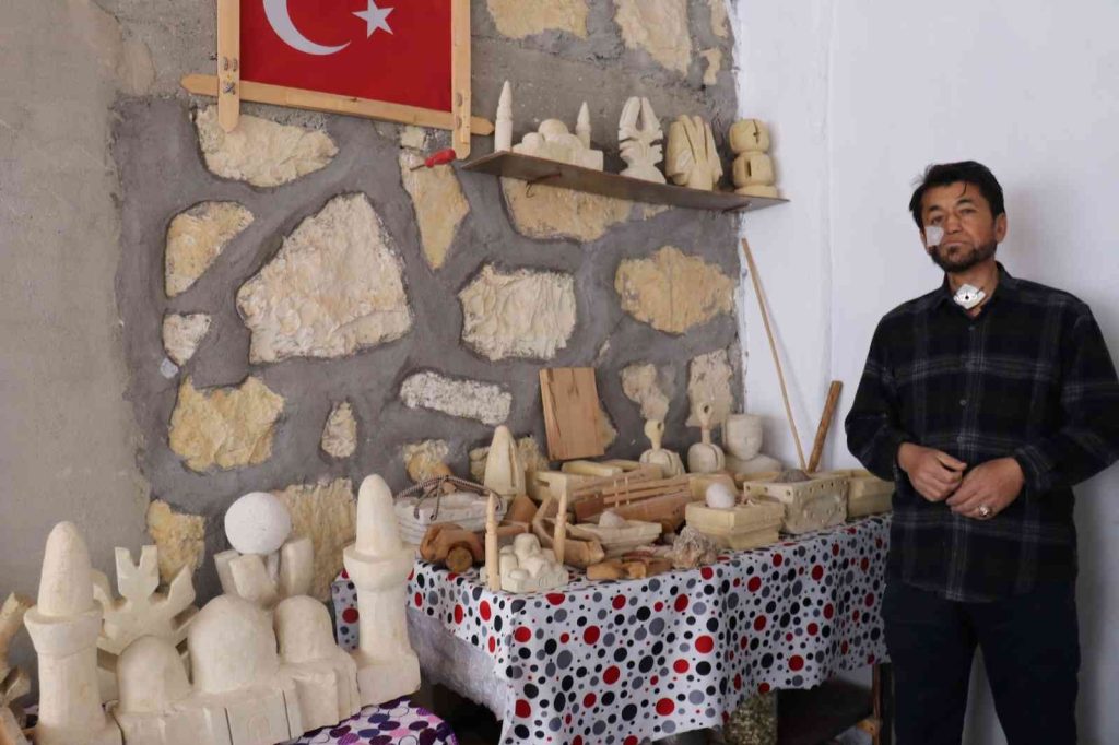 Kansere yakalandı, sanatla hayata tutundu
