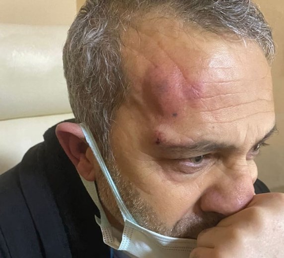 Şanlıurfa’da hasta yakınları sağlık çalışanını darp etti