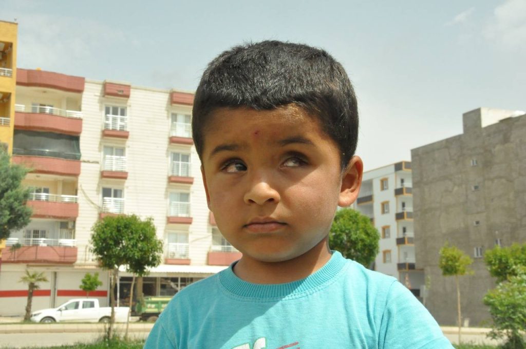 Savaş mağduru çocuğu tümör darbesi