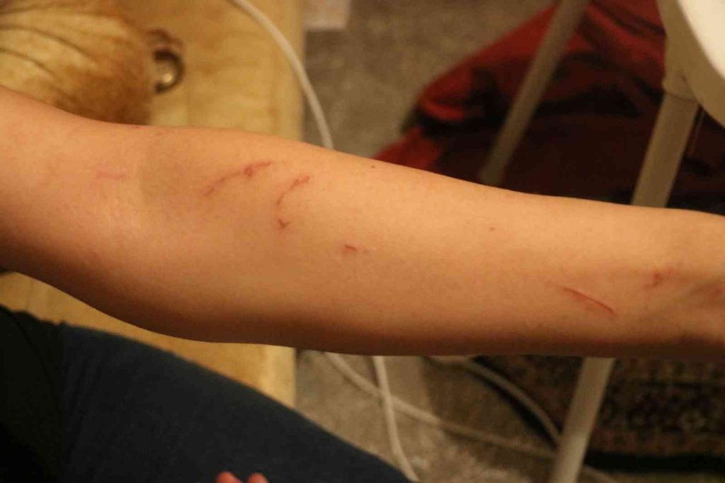 Diyarbakır’da iddiaya göre kiracı kadın ve engelli çocuğu ev sahibinin ailesi tarafından darp edildi